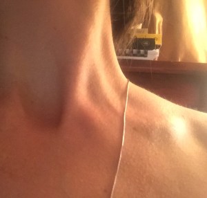 Skin by Nichole Q. Perreault